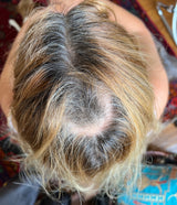 Thinning Hair/Alopecia Protocol