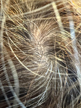 Thinning Hair/Alopecia Protocol