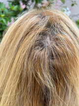 Thinning Hair/Alopecia Protocol